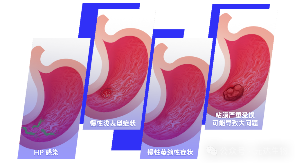 《柳叶刀》发布抗幽新疗法！后生元带来更温和的“养胃”选择